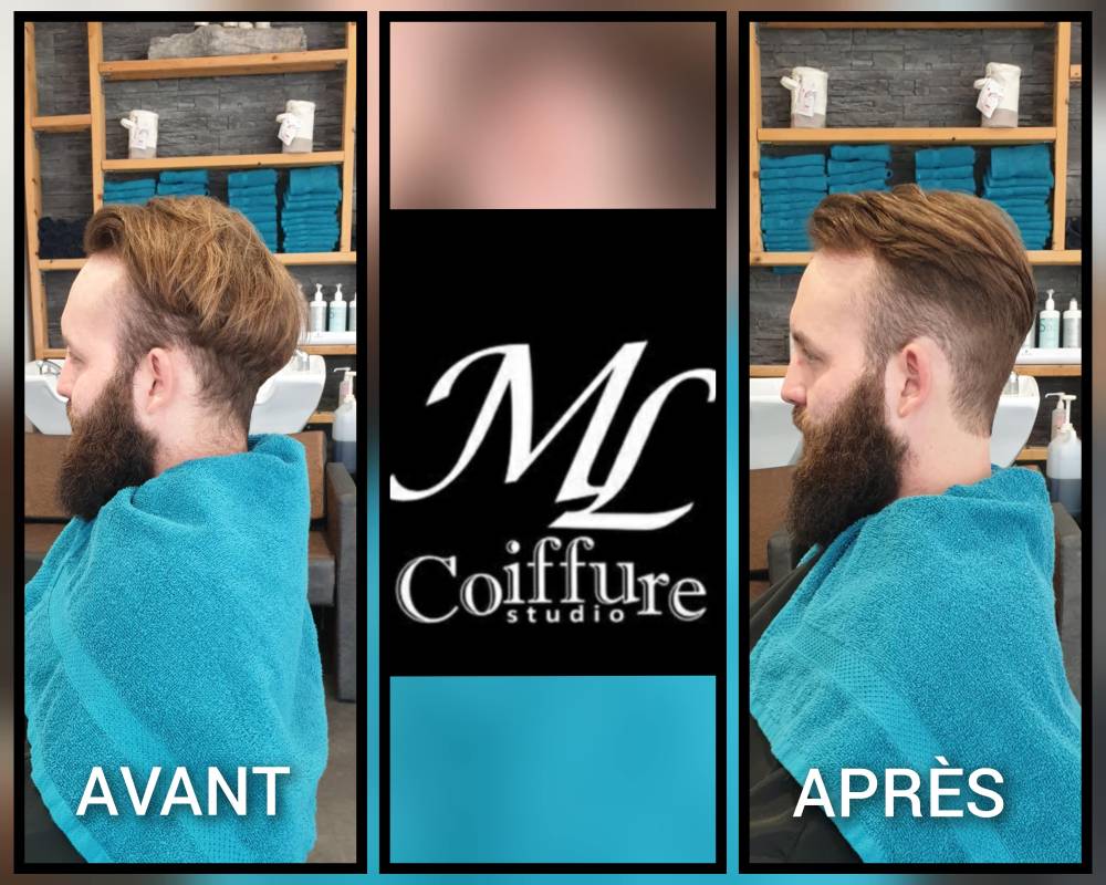 Avant-Après 6-min